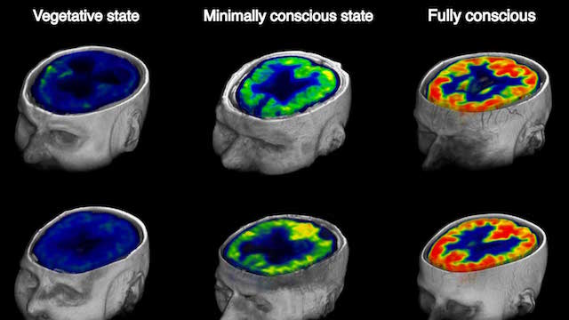 Scientists Tried These Experiments To Discover The Afterlife