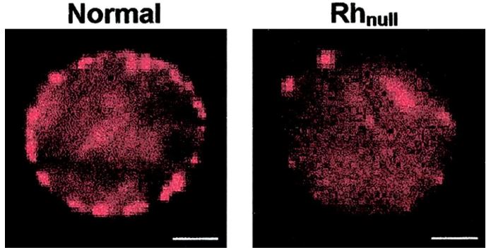 Rare Genetic Traits Most People Probably Don&#8217;t Have