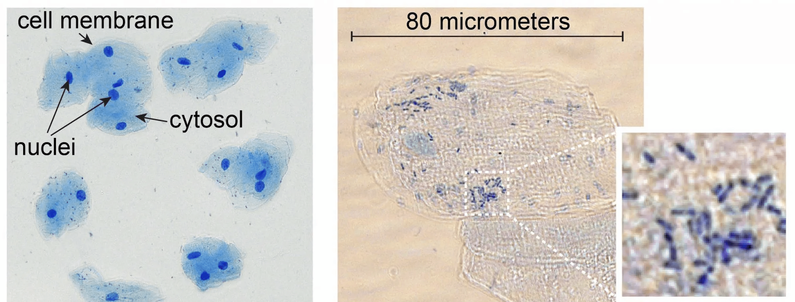 These Everyday Items Turn Into Something Incredible Under a Microscope